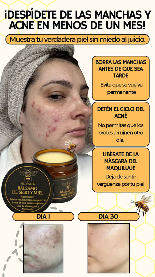 Balsamo de Sebo y Miel