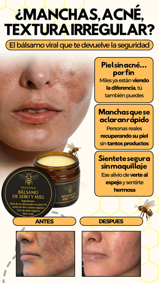 Bálsamo de Sebo y Miel – Adiós Granitos, Manchas y Piel Seca