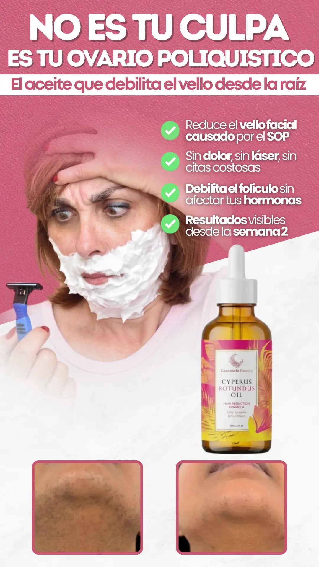 Cyperus Rotundus Oil